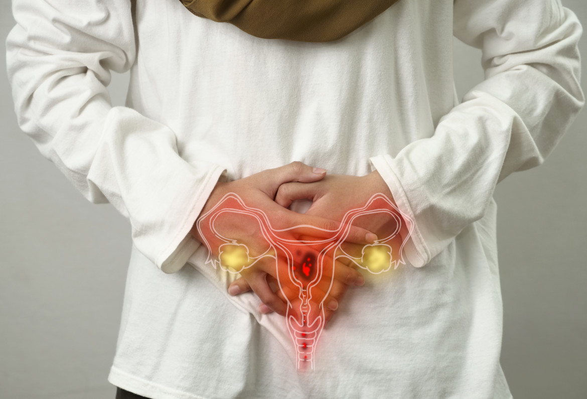 Cisti ovariche - Prenota la tua visita ginecologica a Bologna, Verona e Trento con la Dottoressa Cognigni.